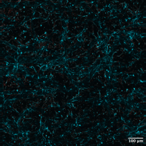 mit-researchers-defy-conventional-wisdom-unveil-self-organizing-laser-for-breakthrough-bioimaging