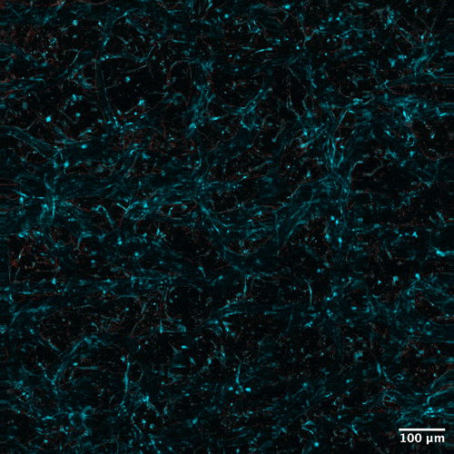 mit-researchers-defy-conventional-wisdom-unveil-self-organizing-laser-for-breakthrough-bioimaging