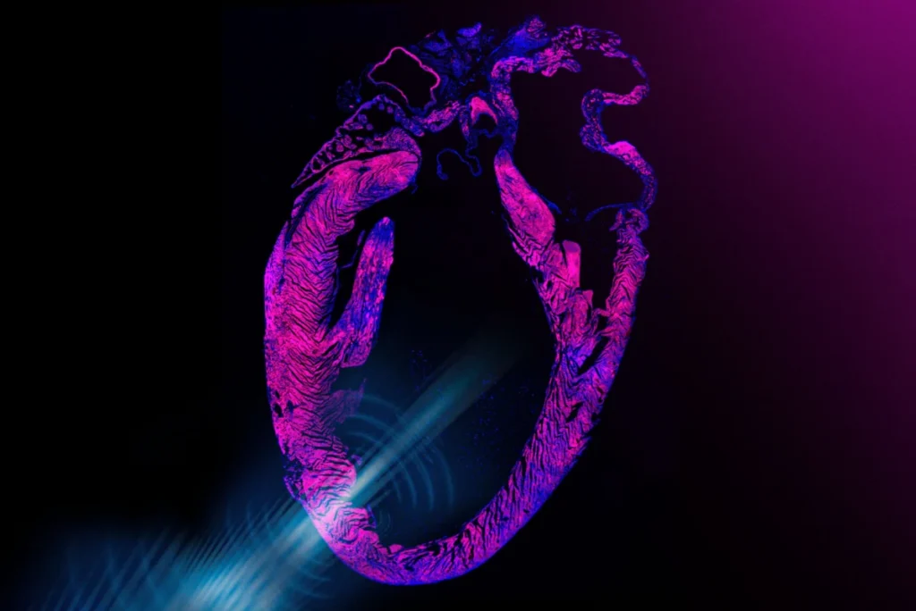 mit-engineers-unveil-noninvasive-ultrasound-pacemaker-promising-a-surgery-free-future-for-cardiac-rhythm-management