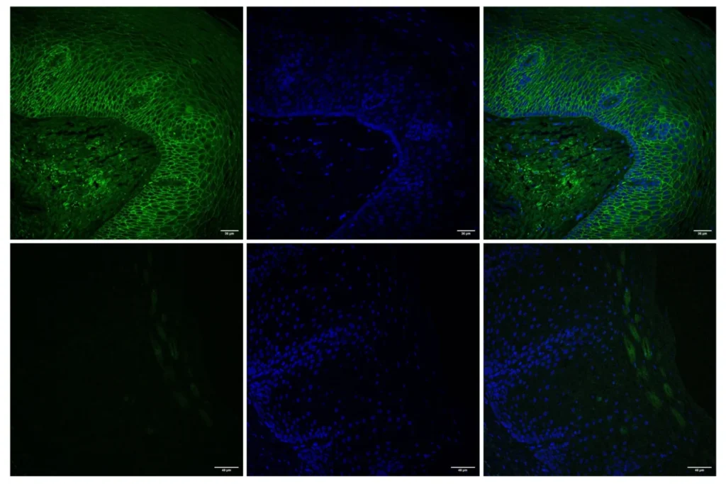 revolutionary-platform-unlocks-targeted-drug-delivery-for-esophageal-diseases