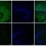 revolutionary-platform-unlocks-targeted-drug-delivery-for-esophageal-diseases