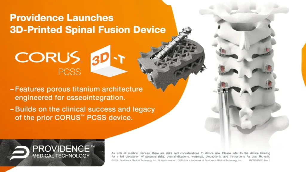3d-printing-news-briefs-october-24-2026-spinal-implant-digital-dentistry-recycled-pla-more-3dprint-com-additive-manufacturing-business