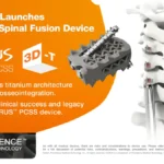 3d-printing-news-briefs-october-24-2026-spinal-implant-digital-dentistry-recycled-pla-more-3dprint-com-additive-manufacturing-business