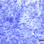 mit-researchers-develop-novel-handheld-device-for-early-targeted-ovarian-cancer-detection-and-personalized-treatment
