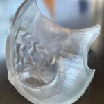 myrava-receives-fda-510k-clearance-for-patient-specific-3d-printed-bolus-advancing-radiation-therapy-precision