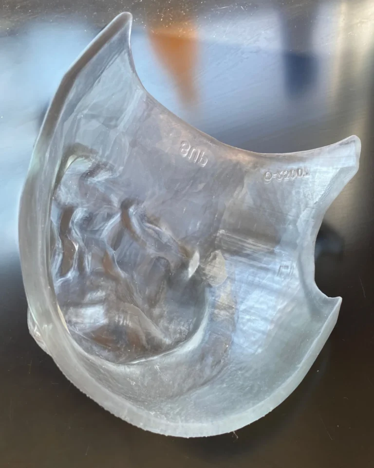 myrava-receives-fda-510k-clearance-for-patient-specific-3d-printed-bolus-advancing-radiation-therapy-precision