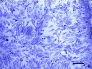 new-cell-collection-device-could-improve-early-cancer-detection