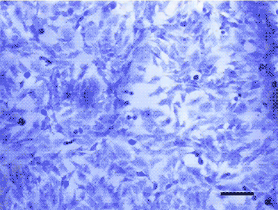 new-cell-collection-device-could-improve-early-cancer-detection